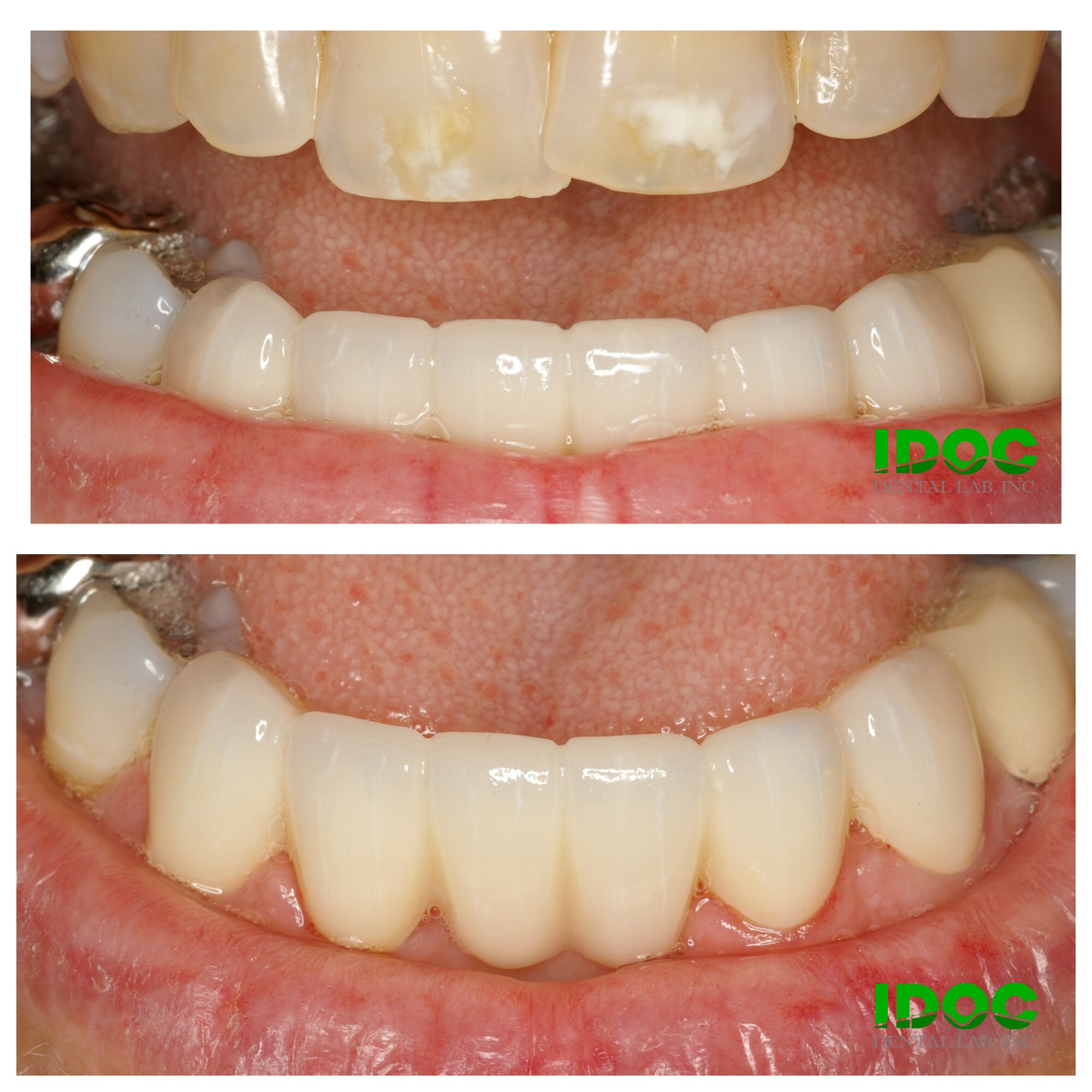 IDOC Dental Lab (IDOCdentalLab) / Twitter