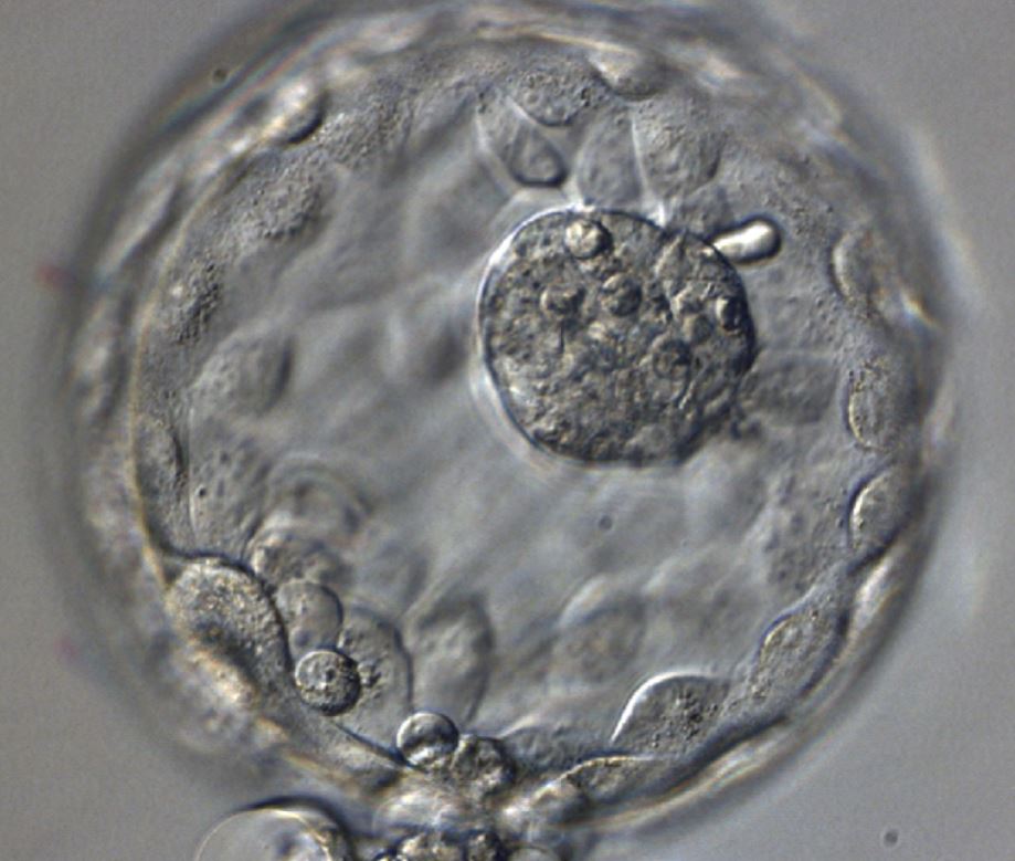 ESHRE SIG Stem Cells tweet media