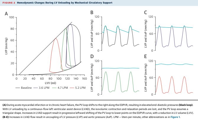 paomorejon's tweet photo. Mechanical Unloading in #HeartFailure
-Post-AMI
•1-year: 25% will develop #HF
•5-years:75% will develop #HF
-Impact of LV unloading with #MCS on reverse remodeling
•Early: ⬇️infarct size
•Late: Myocardial recovery

#CardioEd #FoamEd
@JACCJournals 

https://t.co/Rv20fKakkp https://t.co/ZjTnBnszFx