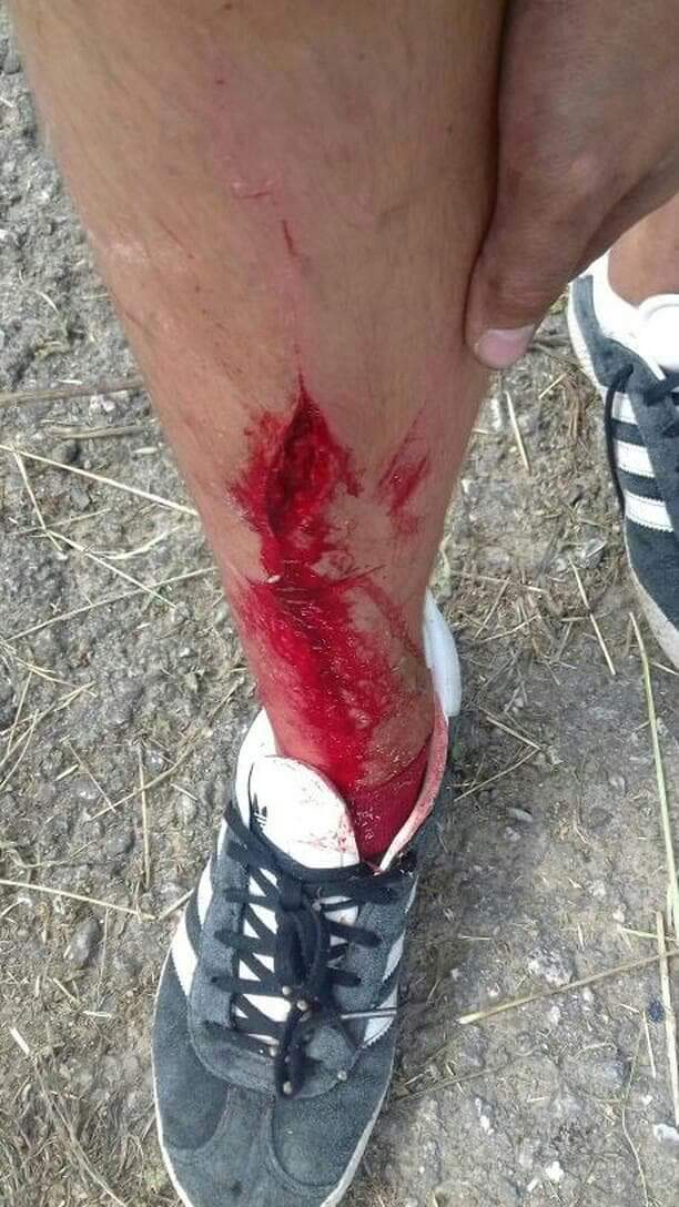 Rt ou 7 anos de azar 🔪