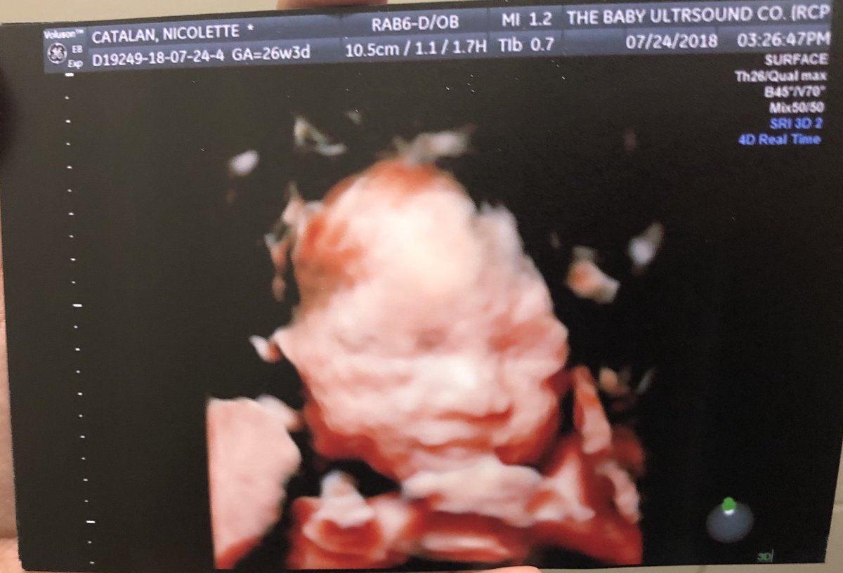 nicoletteannmc's tweet photo. My little Aria.💖 get ready for our hello kitty and twinning eme anak!😘 see you on October my love!!! https://t.co/m9pABY15TV