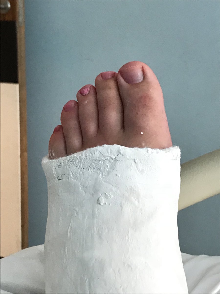 NavarroHPBSurg's tweet photo. Spent the last few days as a patient @nottmhospitals great care from all @TeamNUH especially @benollivere very grateful. @TeamHpb back operating ASAP, @JoFort_nuh @NUHSurgery #managementfocus https://t.co/HfhdpE1Btw