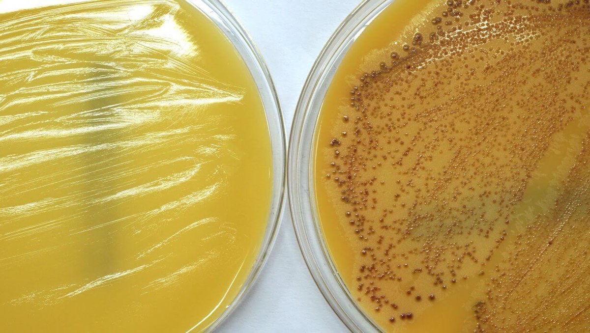 hip_hygiene's tweet photo. How @TUBerlin researchers took advantage of the natural struggle for limited resources to discover a new class of #antibiotics: https://t.co/lCUWacmSRN #Multiresistance #medicine https://t.co/hFHBE0A6Iw