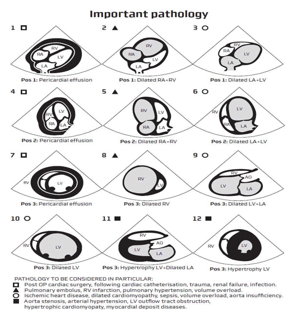 Tim Montrief Twitterissa Excellent Pocket Reference For The Focus Assessed Transthoracic Echo Fate Exam Via Usabcd And Prof Erik Sloth Foamed Emergencymedicine Foamcc Foamus Pocus Pdf Here Https T Co 93yiugvv8f Https T Co Wqzcsugy6t