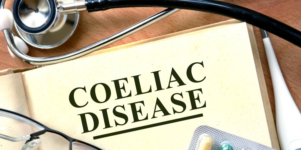 Huw_J's tweet photo. Growing UK businesses through third sector partnerships w/ @Coeliac_UK #InnovateBlog from @MillerKath: https://t.co/06nh6MMX2g  #IndustrialStrategy #HealthInnovation #GlutenFree @UKRI_News #HealthyAgeing https://t.co/HdLWSIhLWb