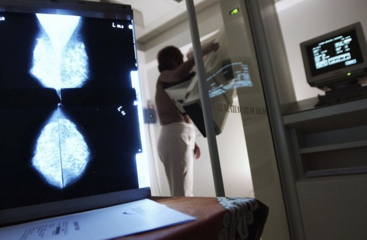 saintlukeskc's tweet photo. Breast cancer cells that hide from treatment can live to metastasize. This study shows two new ways to attack these sleeper cells. #cancer #breastcancer #support #autophagy #murinemodel https://t.co/cb0RwOSVZA https://t.co/9tNbqDMXng