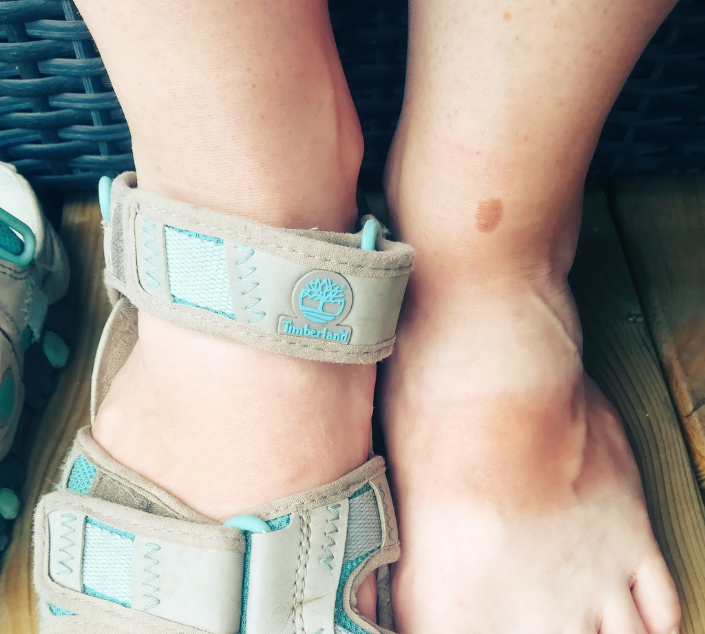 Den här sommaren har gett mej så många svar på livsavgörande frågor. Som vilka skor jag använder mest... #sommar #sol #skor #fel #solbränd #viktigt