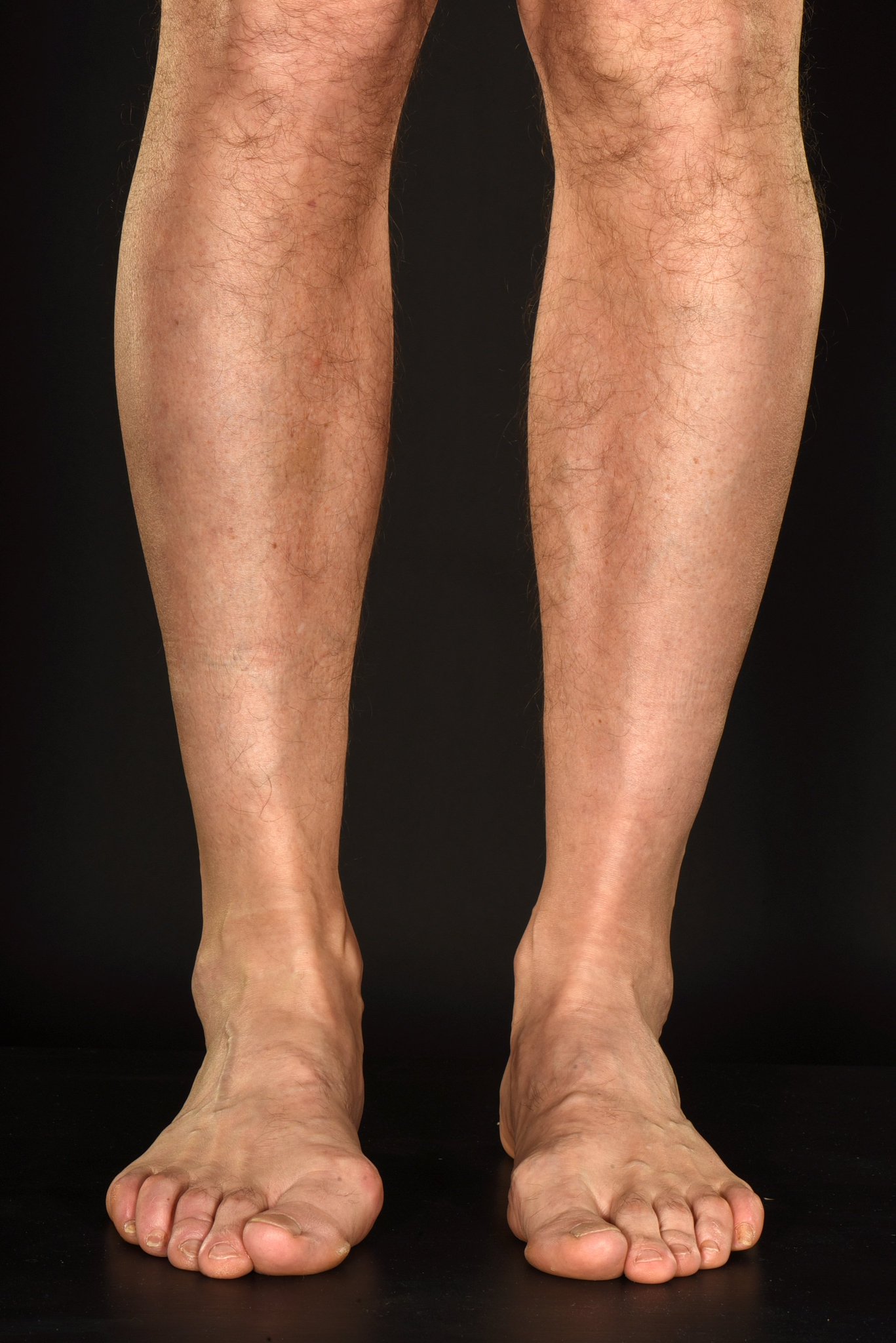 LegsMattter on Twitter: &quot;Healthcare professionals – worried about your