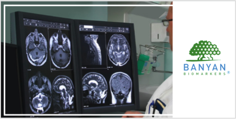 banyanbio's tweet photo. Banyan Biomarkers Announces Publication of ALERT-TBI Clinical Study Results in @TheLancetNeuro 

https://t.co/30cC64eyWb

#TraumaticBrainInjury #Concussion https://t.co/ZIJ75LHt8O