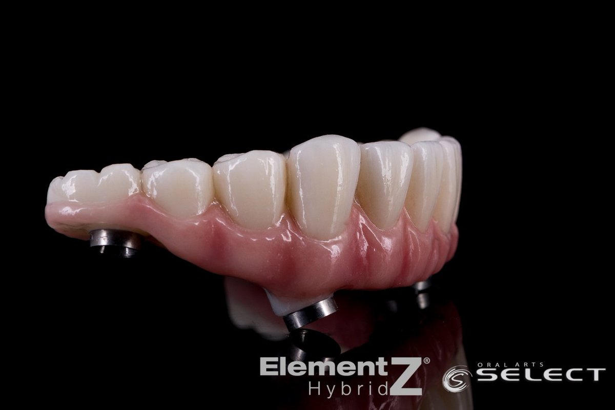 OralArtsDental's tweet photo. Element-Z Screw Retained Hybrid with a GC Gradia Pink Composite for a resilient screw-retained prosthesis!
#OralArtsHuntsville #OralArtsDental #OralArtsDentalLab #DentalLab #OralArtsHybrid #OralArtsImplants #DentalImplants #ElementZHybrid #OralArtsSELECT #SmileMakeOver https://t.co/SwWhnlyie4