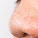 LanasDaySpaNJ's tweet photo. Khloé Kardashian Responds to Nose Job Comments on Instagram https://t.co/IvmUidaGtM https://t.co/WWzgmI1vtj