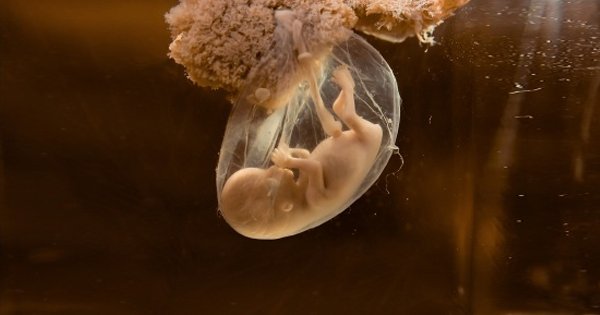 It has never been more important to assess the power of conventional dogma to present reality in a light that is totally divorced from the truth.

buff.ly/2mHfSJJ #kellybroganmd