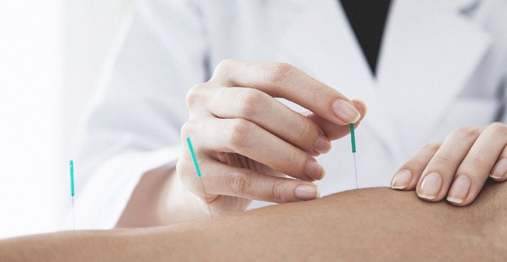 clinicalmeets's tweet photo. Interesting Facts of Cancer at https://t.co/LGZ9jpZAat #Study Acupuncture Reduces AI-Associated Joint Pain in women with breast cancer #CancerConfrence #ClinicalOncology #CancerCauses #NewIdeas_Treatment #mp_MRI #FLI #Cryoablation #Acupuncture https://t.co/S51O5Vs5ac