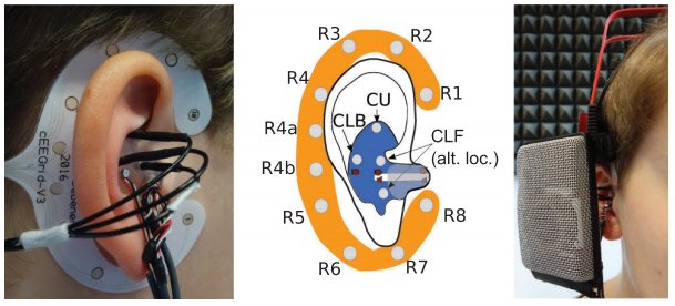 mBrainTrain's tweet photo. A new feasibility study where #earEEG is integrated with a live hearing device 🎧
The #EEG analysis revealed significant differences between trials with and without a switch in the device settings in the N100 and P300 range of the ERP. #SMARTING
More: https://t.co/kiX0MeJEuy https://t.co/Gpd9ADyJnZ