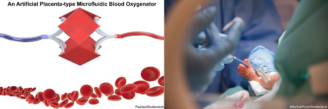 uFluidix's tweet image. Blood oxygenators advancing microtechnologies with their unique design so much similar to nature lungs could solve pre-term baby underdeveloped lungs problems:
ow.ly/73kc30l76wU

@WHO  @GetingeGlobal 
#ArtificialOrgans #PretermBirth #microfabrication #microfluidics