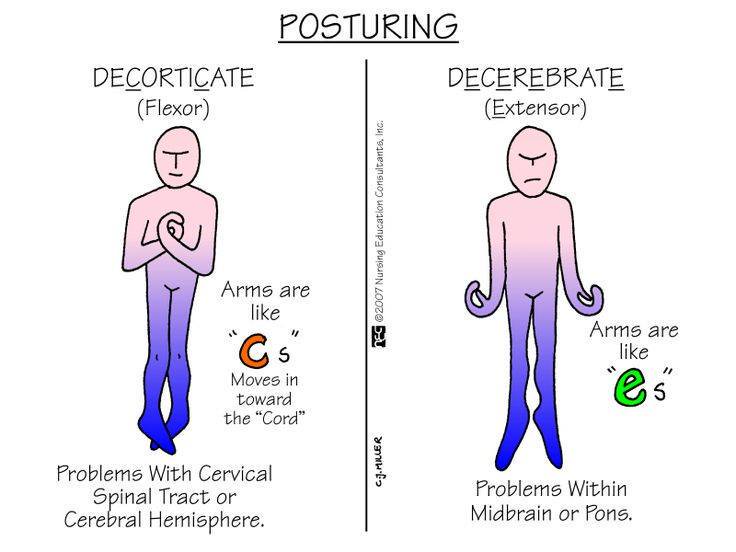 Here are some potential reasons for victim posturing. 

#EMS #PatientCare