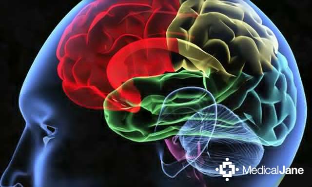 Cannabidiol (CBD) May Prevent Buildup of Excess Iron In The Brain bit.ly/1zUVG4q