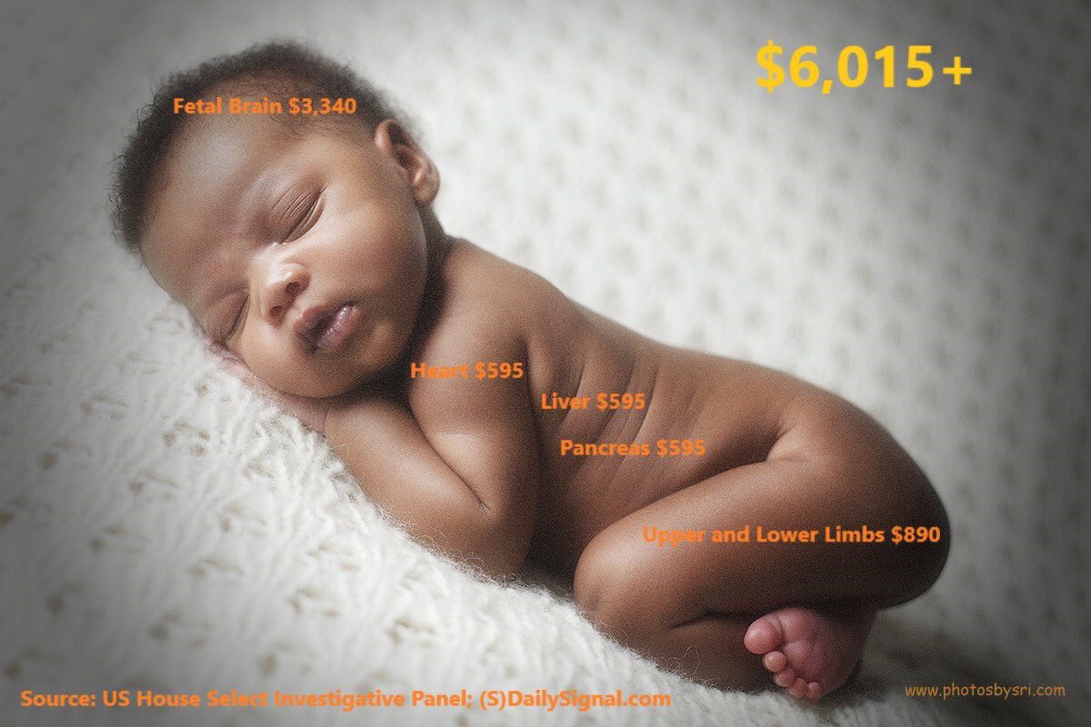 witrayler's tweet photo. @POLITICSandFUN @DartLucy @Taryn8675309Tom Follow the money...Trafficking in #humanbodyparts is profitable for #PlannedParenthood and needs to be shutdown.
#DefundPP #AdoptionNotAbortion #SaveBabyHumans #ProLife #TinyLivesAtStake #ChooseLife #VoteDemsOUT #Trump2020Landslide https://t.co/EiqOv78Aqm