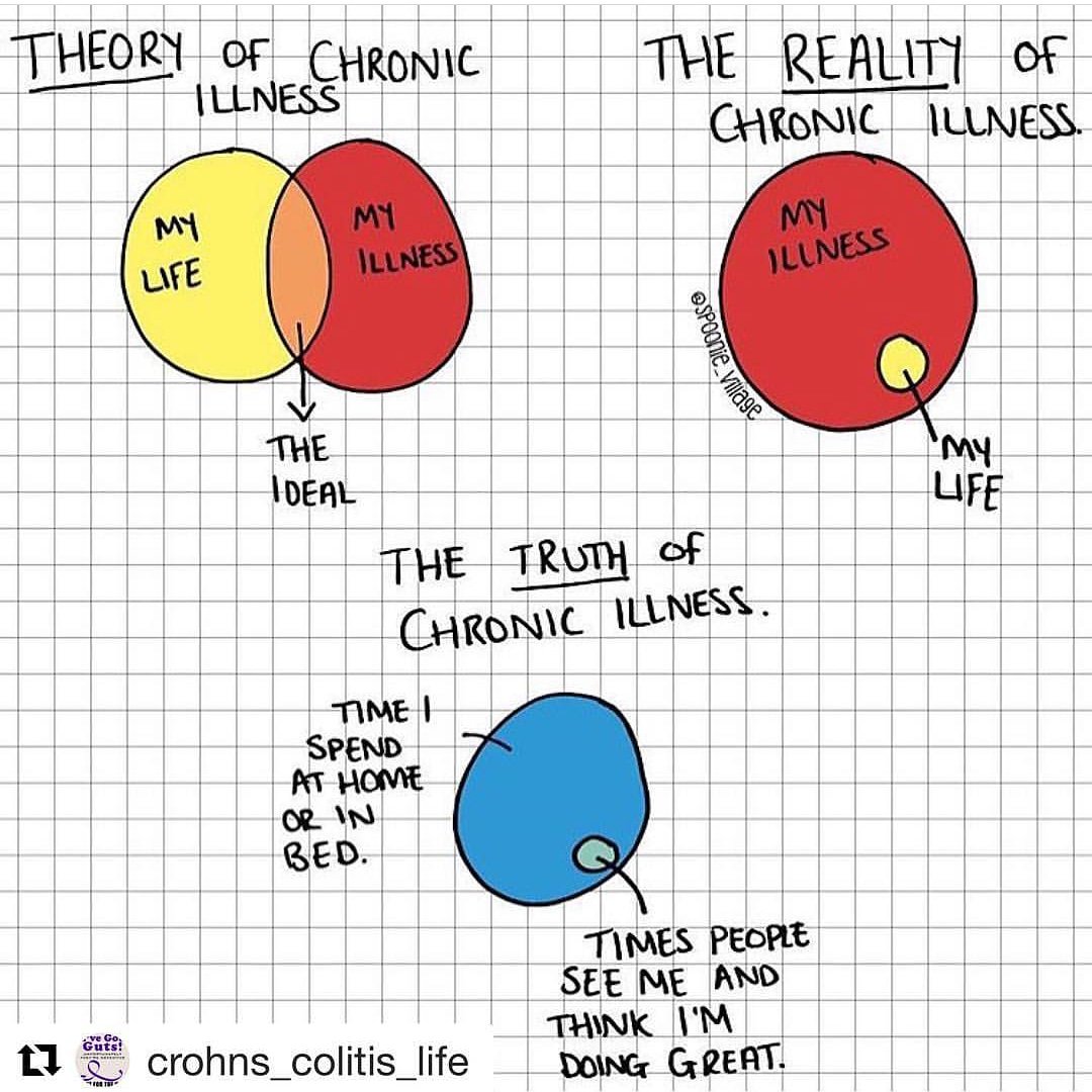 danybobz's tweet photo. Bahahaha, it's quite sad really.
🥄🥄🥄
#spoonie #ehlersdanlossyndrome #arthritis #warrior #healthy #fibromyalgia #disability #wellness #bepositive #zebras #rare #disease #awareness #chronicillness #chronicpain #fragilebutunbreakable #chronicfatigue #icarebecauseimrare https://t.co/WF7QZeW4Td