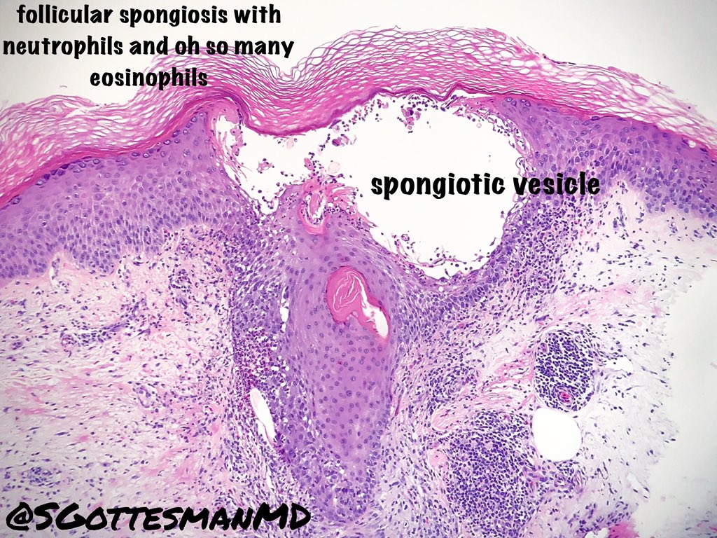 Silvija Gottesman MD tweet media