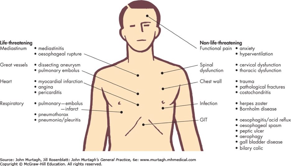 pain in centre of chest