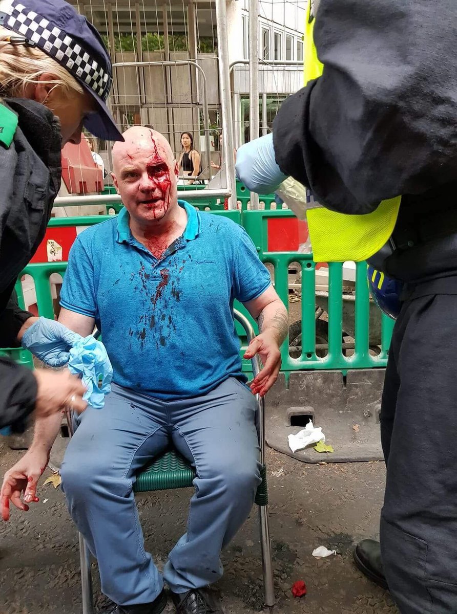 UnityNewsIndie's tweet photo. Assistant General Secretary of the National Union of Rail, Maritime and Transport Workers (RMT), Steve Hedley, today has been brutally attacked by Tommy Robinson fanboys. Make no mistake when fascism arrived in Britain it didn’t come with a swastika, it came with suited men 🤬 https://t.co/X4vF4Ybjet