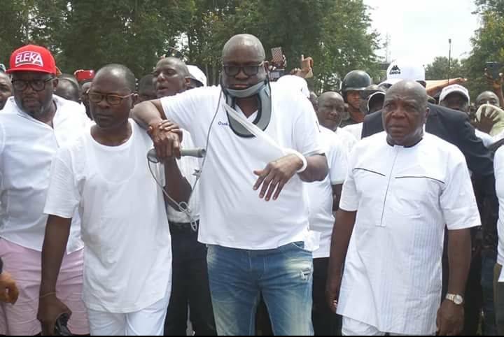 Showrey_Kinging's tweet photo. Now that the storm is over, can daddy please remove this thing? #EkitiDecides2018 https://t.co/FcTQoVVOaf