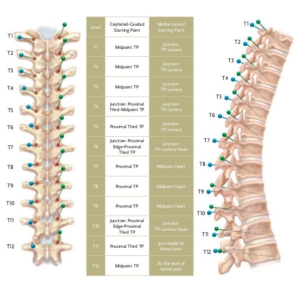 StanfordNsurg's tweet photo. RT @CleSpineReview: #Freehand thoracic #PedicleScrew starting points & trajectories #CLESpine https://t.co/Hz0DLb2bVs