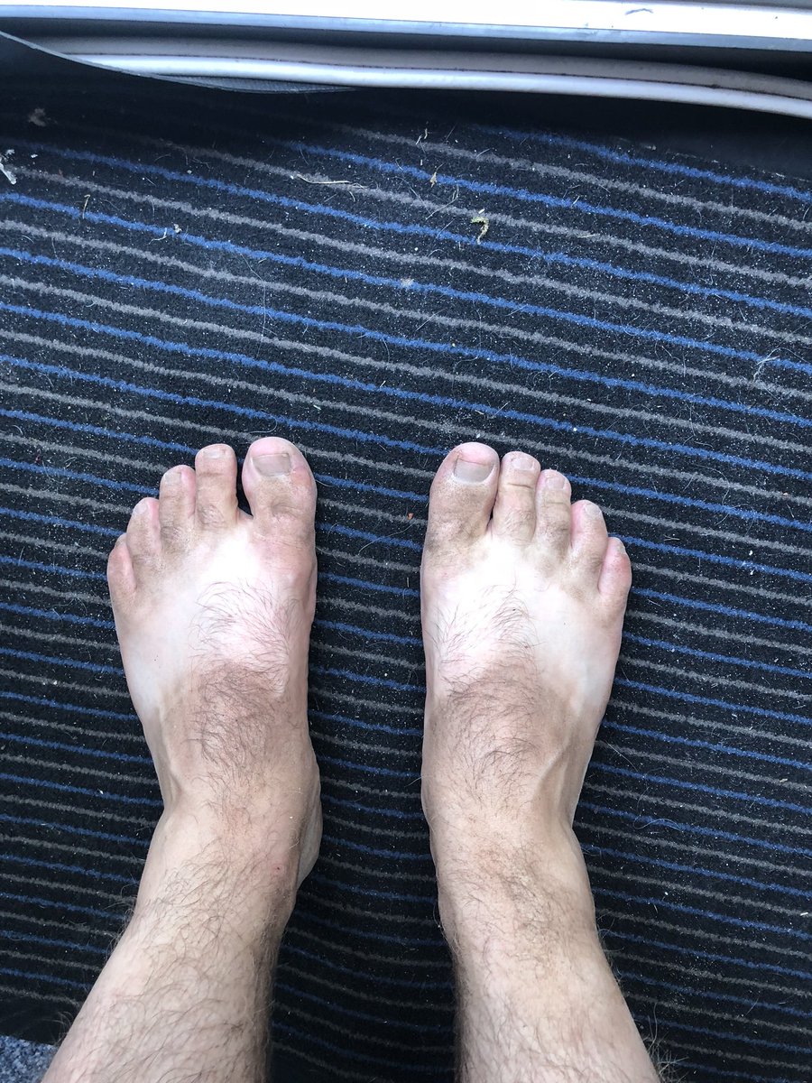 ChrisPlatts8's tweet photo. #FlipFlopProblems https://t.co/d6nEiC791A
