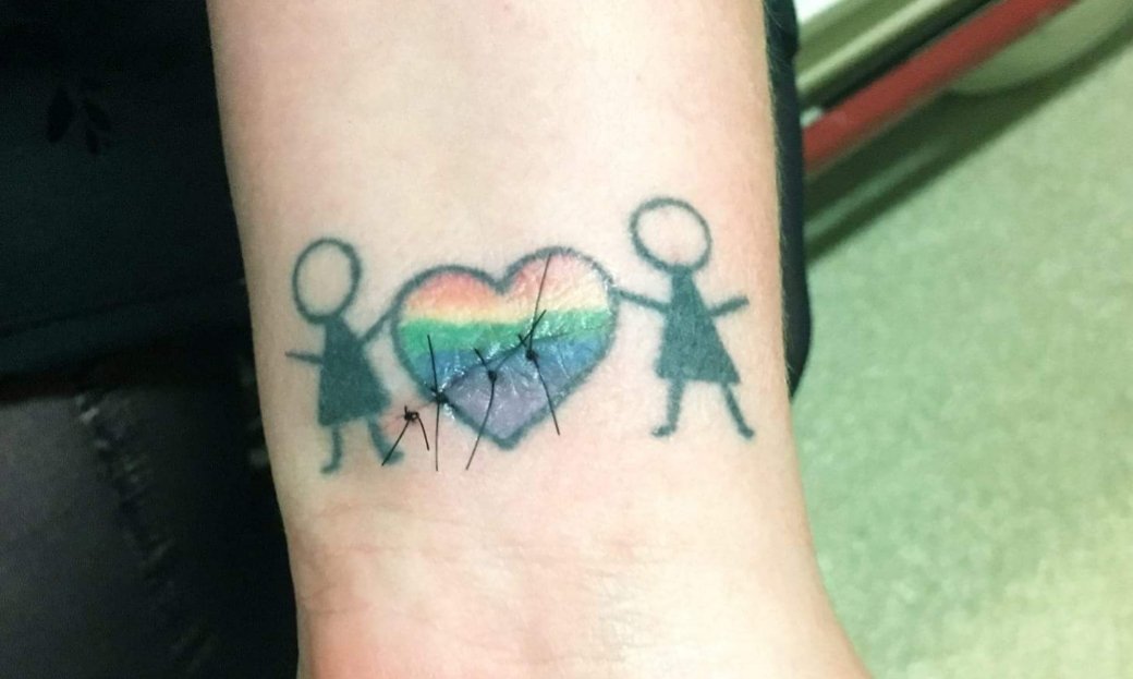 dacrabz's tweet photo. My wife accidentally cut herself at work. She had to get stitches. This is all I could think of:
#WynonnaEarp #Earpers #dochicks https://t.co/LvWyWmKLSh