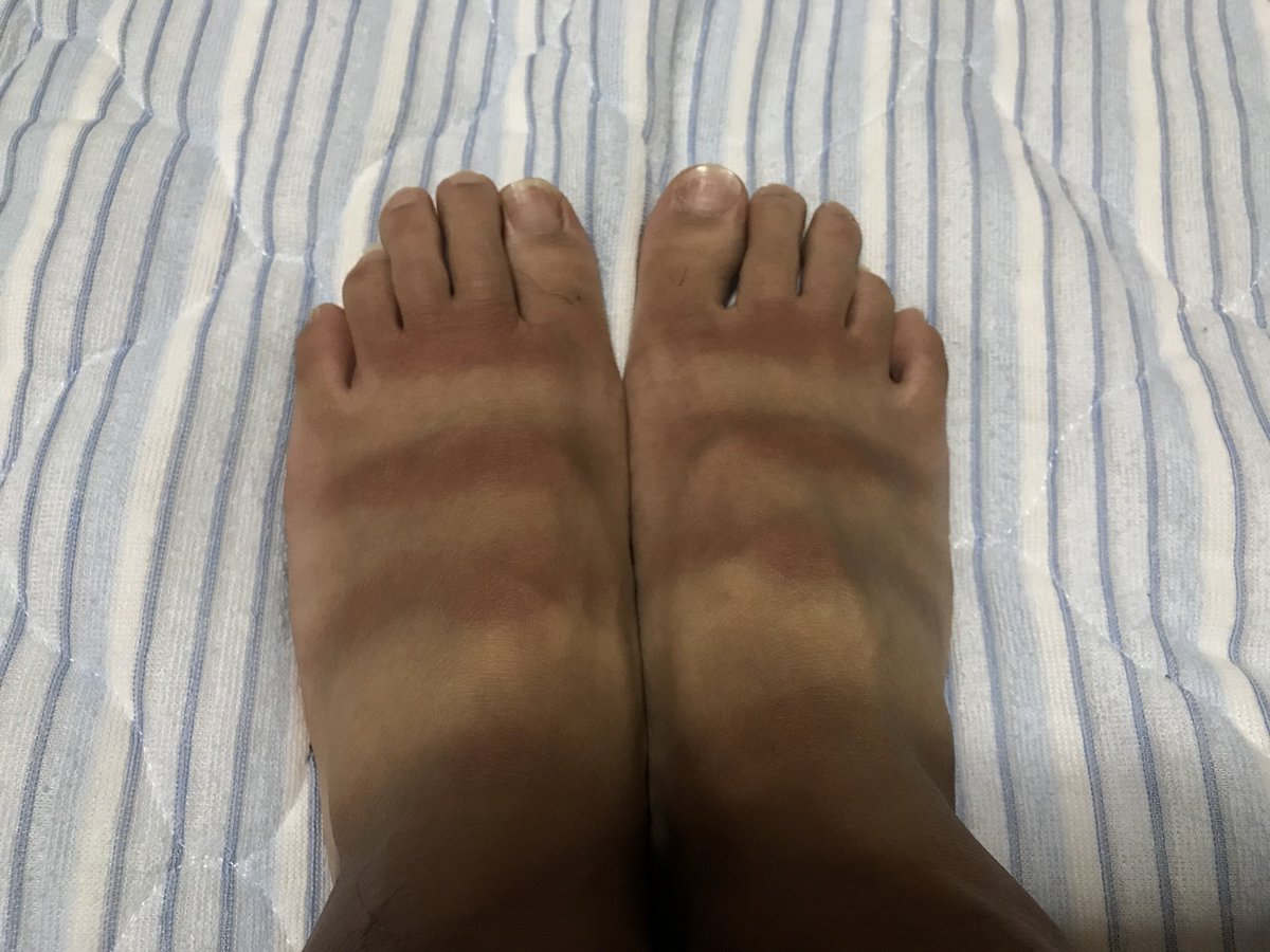 Lunker S ランカーズクシロ בטוויטר 暑ーい 夏はやっぱしサンダルです 船釣りにも水辺でも水はけの良いサンダル各種取り揃えております 私が夏のジギング時に使用中のモンベル キャニオンサンダル 船中でも滑りづらく重宝してます 日焼け跡の足の甲も