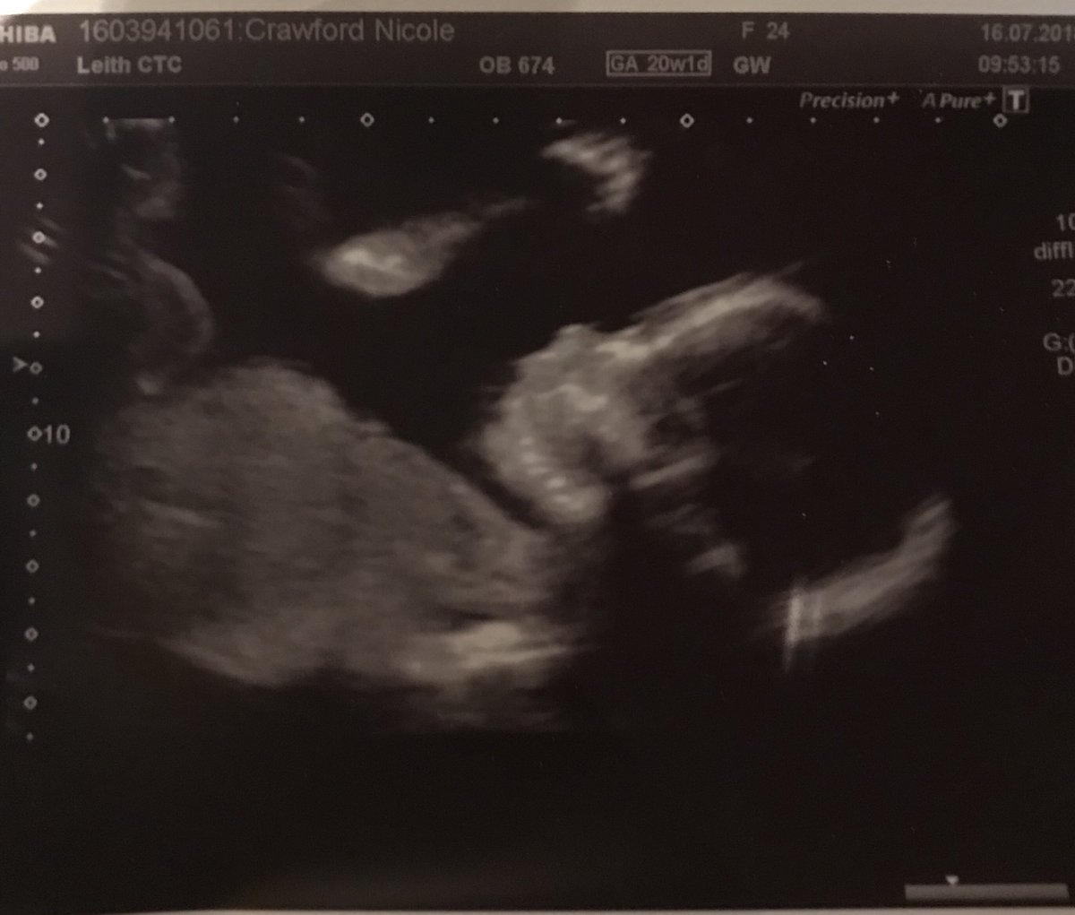 _nicolecrawford's tweet image. Baby boy 👶🏻💙 #babyno2