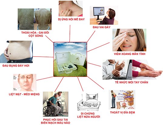 sieuthihaichau's tweet photo. Giảm đau đớn với cách hơ nóng bằng máy cứu ngải https://t.co/YuIcb5pFh4 https://t.co/yuL3GRXtRu
