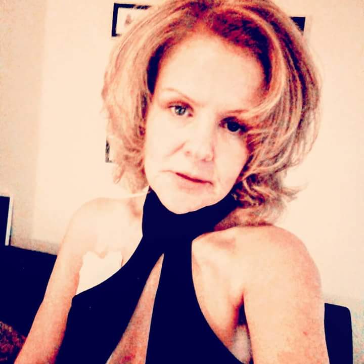 #stoma #bodyimage #ileostomy #TPN #artificialfeeding #FAP #stomafashion