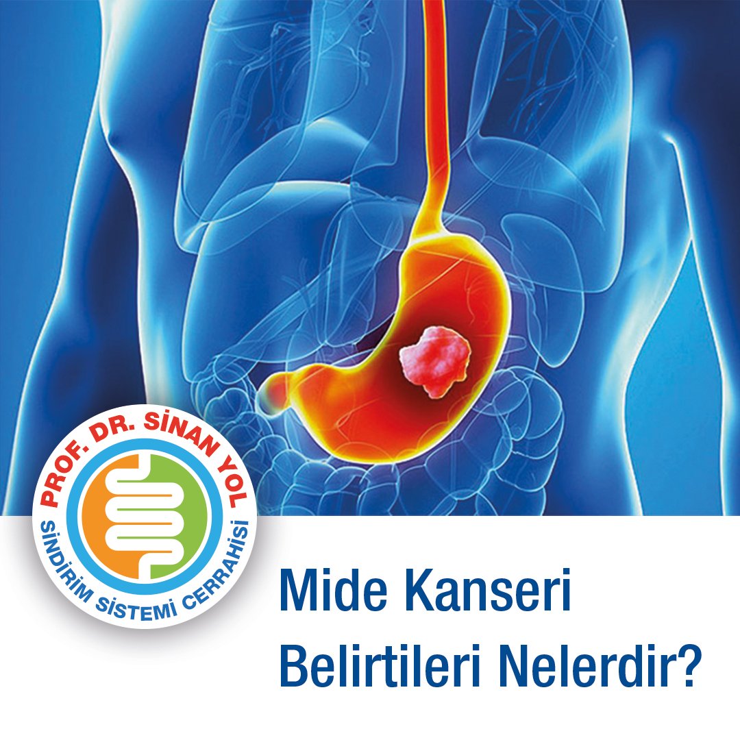 Duodenit: Tedavi, Belirtiler Duodenit: Tedavi, Belirtiler