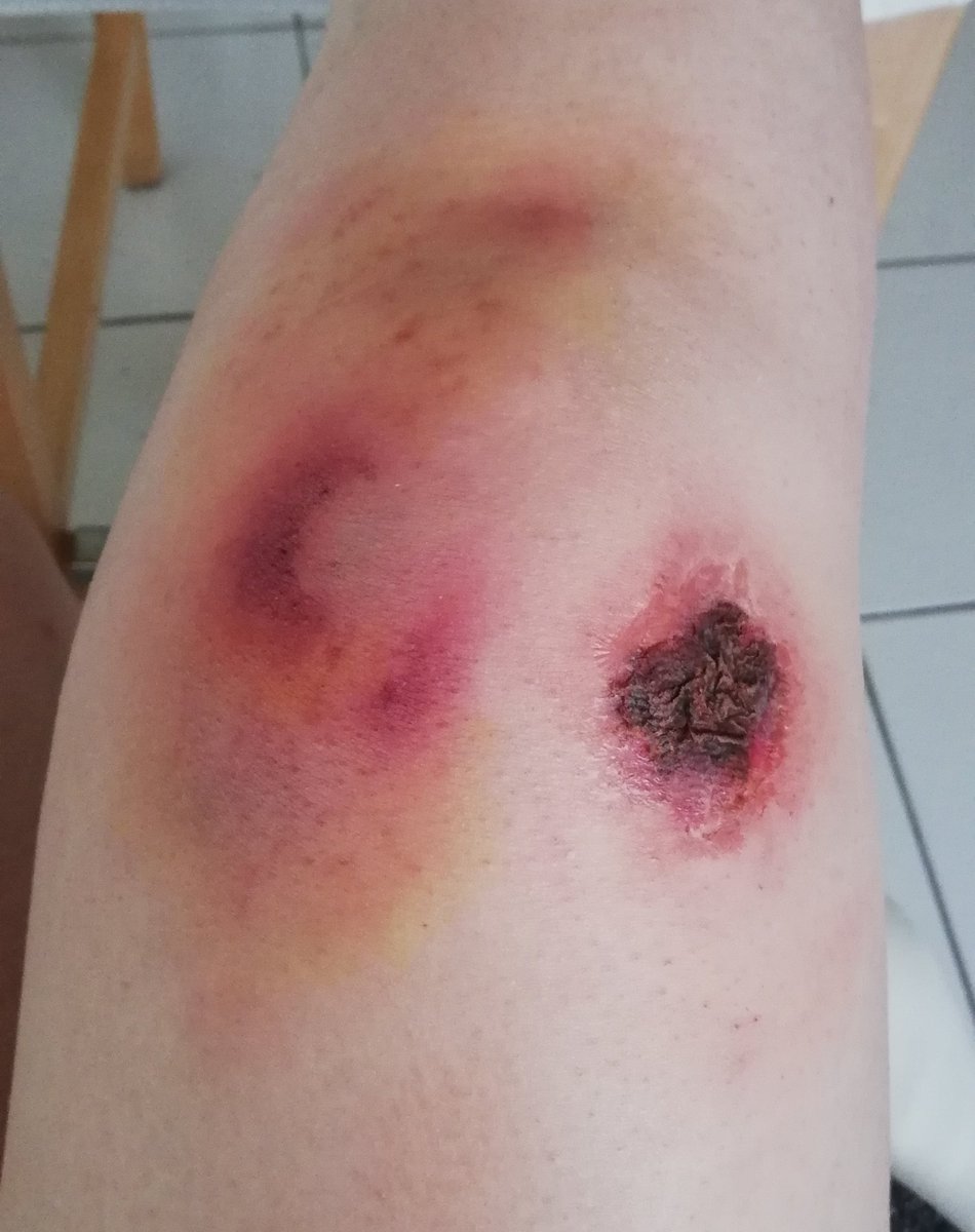 GorryNot's tweet image. Training of the day. #sfx #makeup #mua #makeupartist