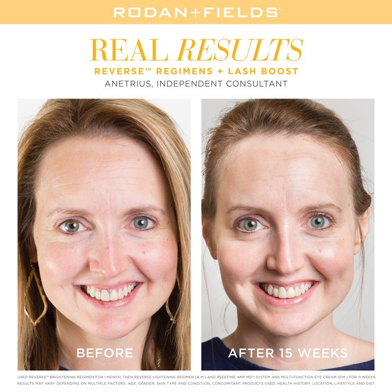 RodanFieldsHQ's tweet image. Wondering whether you can keep using your #ReverseBrighteningRegimen during the sunny season? You can — just wear a hat and shades, and always, always use the Reverse sunscreen!

You can buy a travel-size Reverse Regimen here: bit.ly/2JrjB7a.