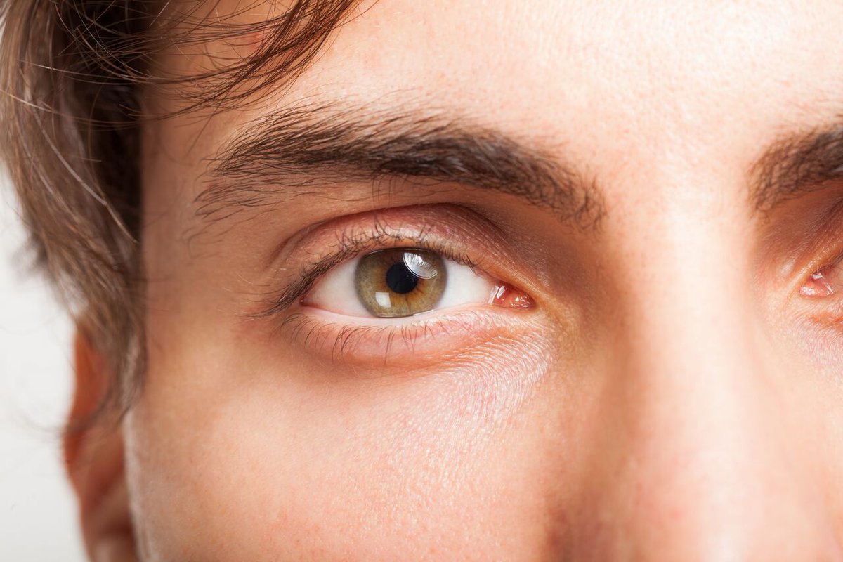 Iron Deficiency on Twitter "Your eyes reveal a lot about your health