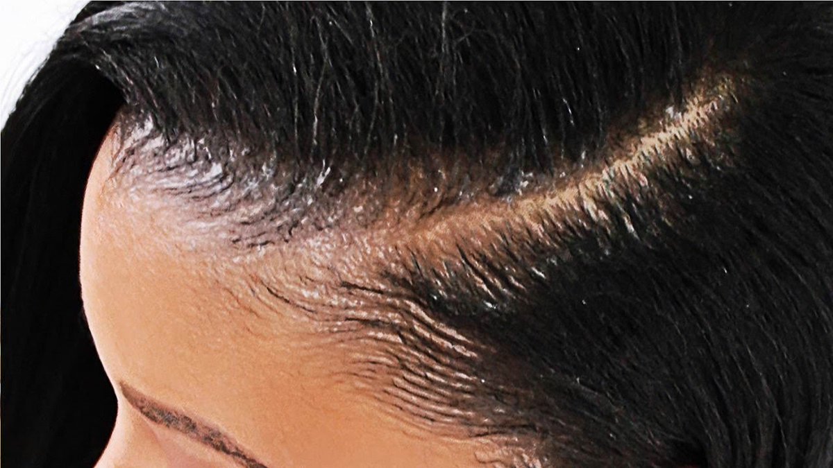 BlackHairInfo's tweet image. Partial Sew In Weave Tutorial IN DETAIL! [Video] #partialsewin  rviv.ly/unGIZe