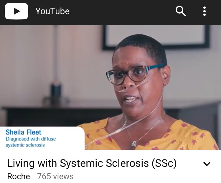 SFGWDC's tweet image. This video was done through Patients as Partners in October 2017 in Crystal City, VA and features one of our members - Sheila Fleet. Sheila has been working with Patients as Partners for two years. —> bit.ly/2LpZQP9 #Scleroderma #sclerodermaaware