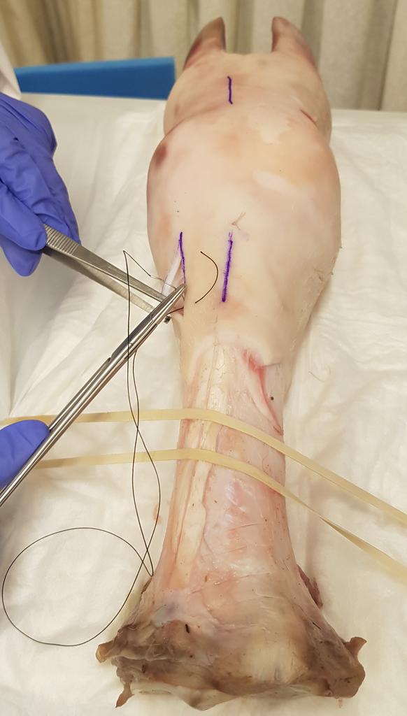 BOSS_COURSE's tweet photo. Basic Operative Surgical Skills #BOSSCOURSE 15-19 July Riyadh #SFH DAY 3. https://t.co/nHTGlaZJ2X