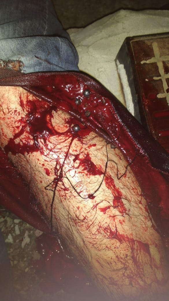 tuteavila's tweet photo. #SanLorenzo. Ayer el operativo en Sarandi fue penoso. La gente llegó con lo justo porque es un dia laboral. Pero los controles previos al puente generaron un embudo innecesario y la policia casi cuerpo a cuerpo disparó balas de goma contra la gente. Un hecho repudiable!! https://t.co/9yitW7iLq4
