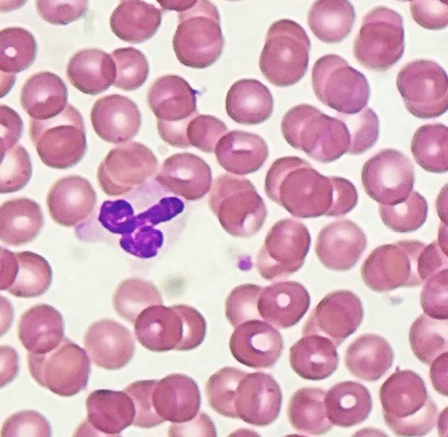 <a href="/IHeartHisto/">I Heart Histo</a> I’m not sure what to think this one is saying 😜<a href="/IHeartHisto/">I Heart Histo</a>  #WorldEmojiDay