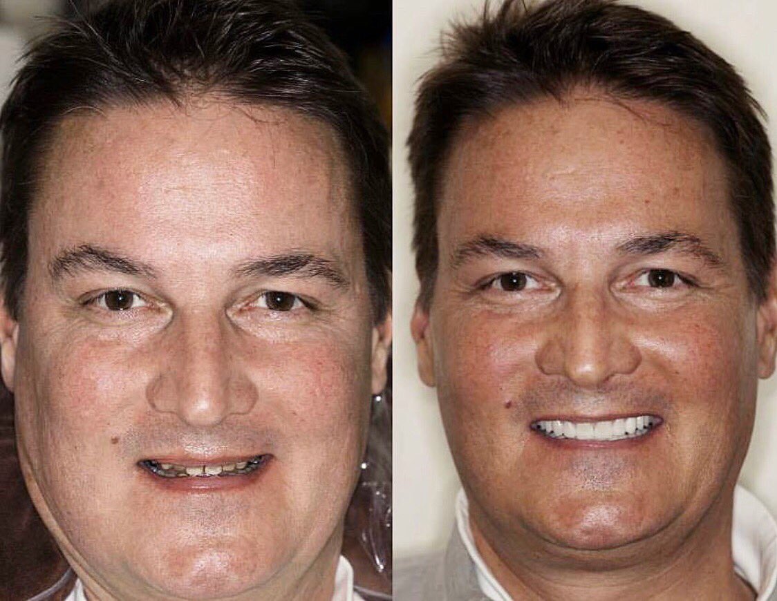 LowenbergLituch's tweet photo. 😁✨ #transformationtuesday https://t.co/GawIeChuzd https://t.co/Fs5dzYAkxK