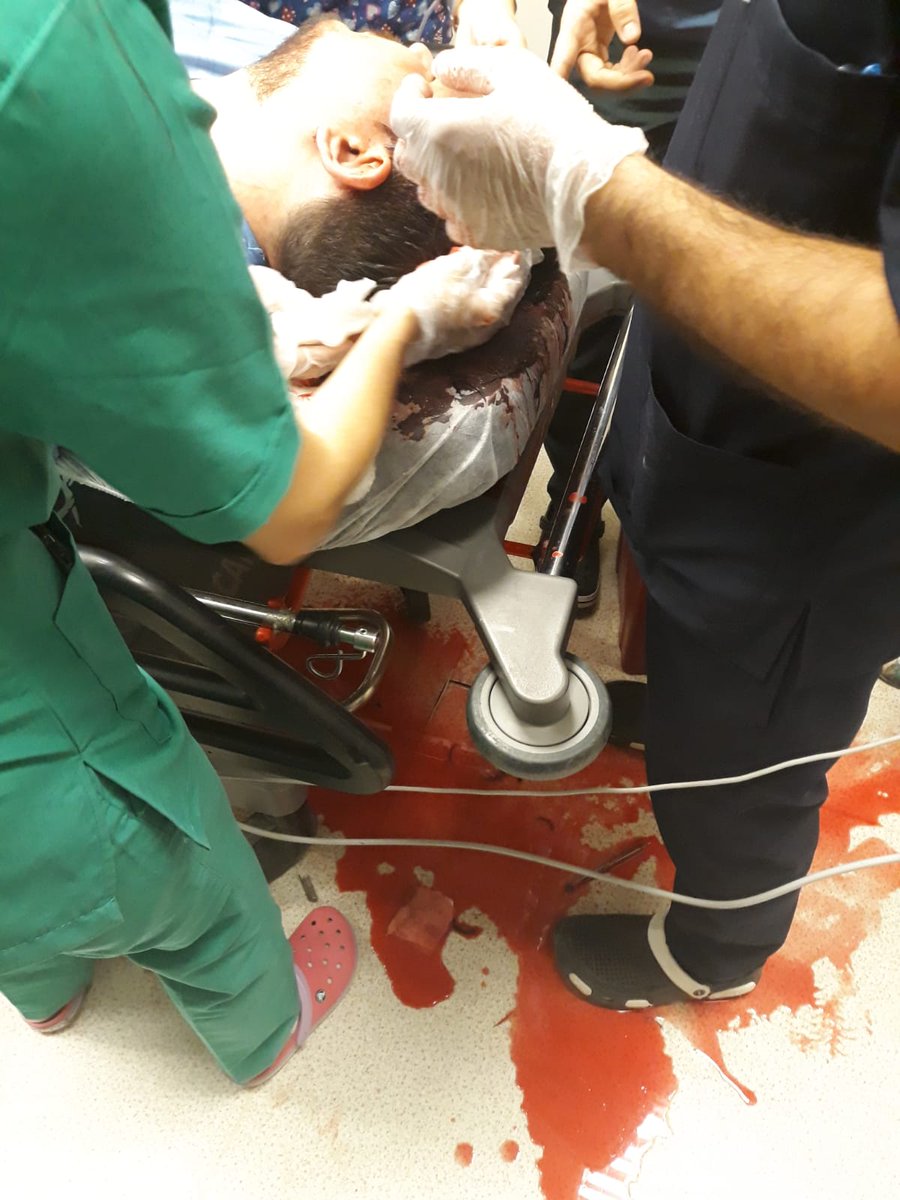 Ş.Urfa Harran Üniversitesi Tıp Fak. Hastanesi'nde hasta yakınlarının kaldırım taşıyla saldırdığı Dr.Bahattin Ahmet Yalçın yoğun bakımda.
Adalet yetkilileri;
Hekimlere şiddet eylemlerinde ceza ertelemeyi kaldırın.
Bu şiddet değil resmen öldürmeye teşebbüslü cinayet.
#ArtıkYETER