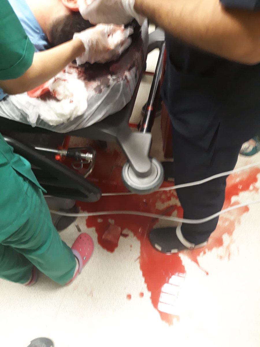 drmehmtkocaoglu's tweet photo. Bir Hekimin kafasında kaldırım taşı kırılıyor. bunu yapan insan mı? hayati tehlikesi var Aslstan Dr bahattin abimin.
Harran Tıp pediatride beraber çalıştık en masum en sevilen en şefkatli kişilerden biri.
Eliniz Kırılsın.
#hekimeŞiddet #artıkyeter #doktorsuzkalın https://t.co/J93ISqTdMS