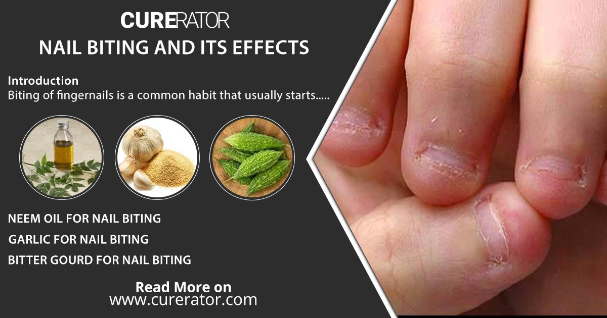 Mark17475210's tweet photo. @CureratorSays For every #health_problem, there is a #natural_remedy. The best #natural_remedies for #health and #fitness problems are accessible on this remarkable platform. https://t.co/iph6YRflJS