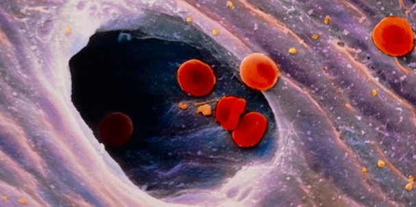 We all have a circulatory system, but if blood can’t flow properly through your veins &amp; arteries it puts you at risk. We research circulatory conditions ranging from #stroke to vascular dementia: bit.ly/2NcTIKj