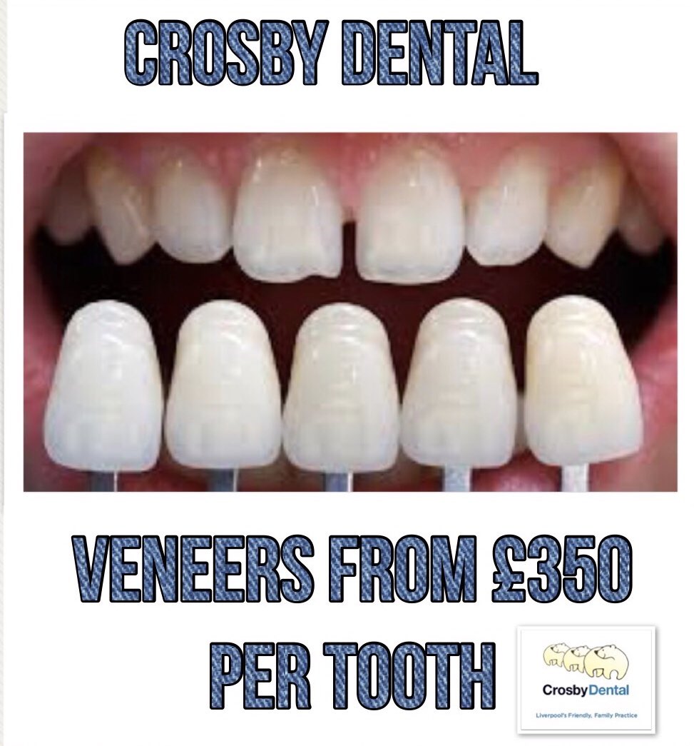 Have you ever wanted veneers?

Veneers from £350 per tooth

Book your consultation now on 01512860330

#veneers #crosbydental #dentistliverpool