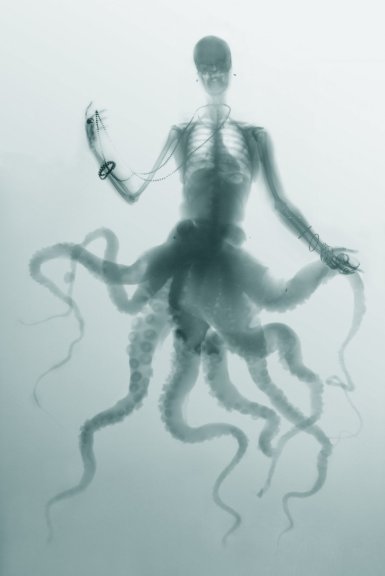 Forgotten_Hill's tweet photo. Browsing through #xray works by italian artist #benedettabonichi we thought we've seen a familiar figure... https://t.co/uSDelI9B9H
